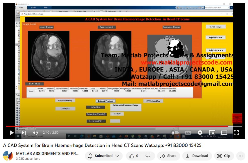 A Cad System For Brain Haemorrhage Detection In Head Ct Scans project simulation thumbnail for Signal Processing and AI Engineering
