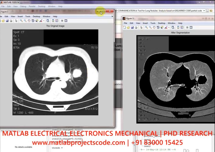 A Tool For Lung Nodules Analysis Based On Segmentation And Morphological Operation project simulation thumbnail for Signal Processing and AI Engineering