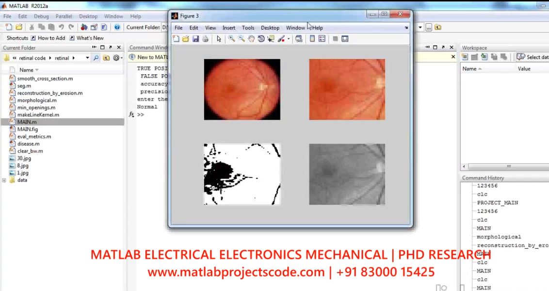 Analysis Of Retinal Blood Vesselsusing Image Processing Techniques project simulation thumbnail for Signal Processing and AI Engineering