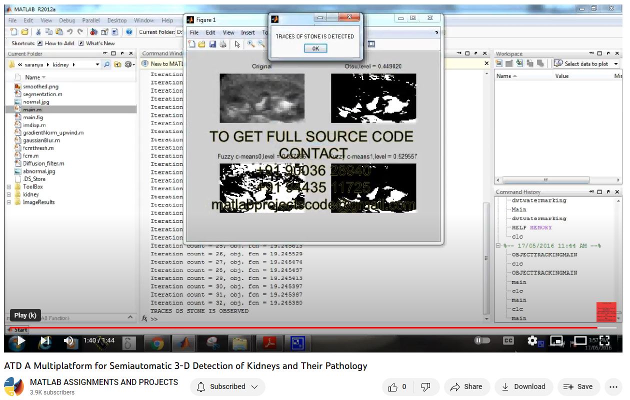 ATD A Multiplatform for Semiautomatic 3-D Detection of Kidneys and Their Pathology project simulation thumbnail for Electromagnetics and RF Engineering