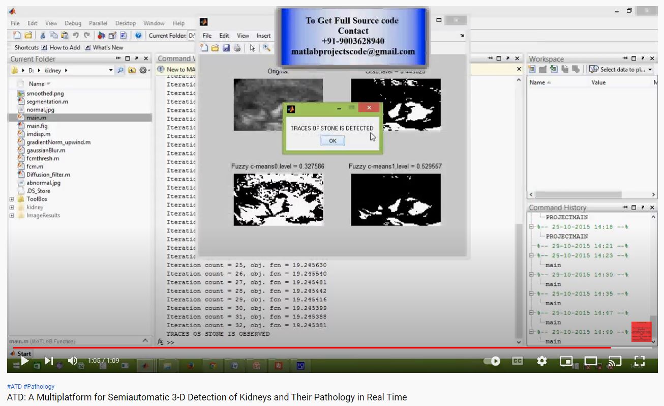 ATD_A Multiplatform for Semiautomatic 3-D Detection of Kidneys and Their Pathology in Real Time project simulation thumbnail for Electromagnetics and RF Engineering