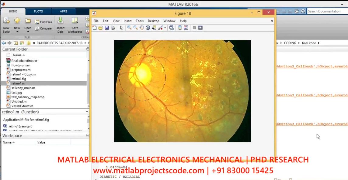 Automatic Detection Of Retinal Lesions Using Fuzzy Logic project simulation thumbnail for Control Systems Engineering