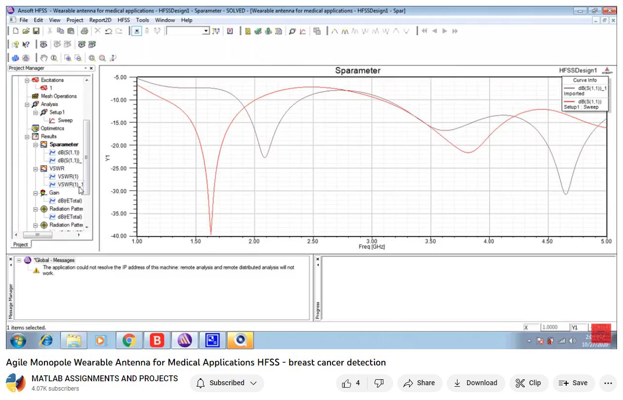 Agile Monopole Wearable Antenna For Medical Applications Hfss - Breast Cancer Detection-Matlab-Electrical Assignments-Projects-Phd Research project simulation thumbnail for Electromagnetics and RF Engineering