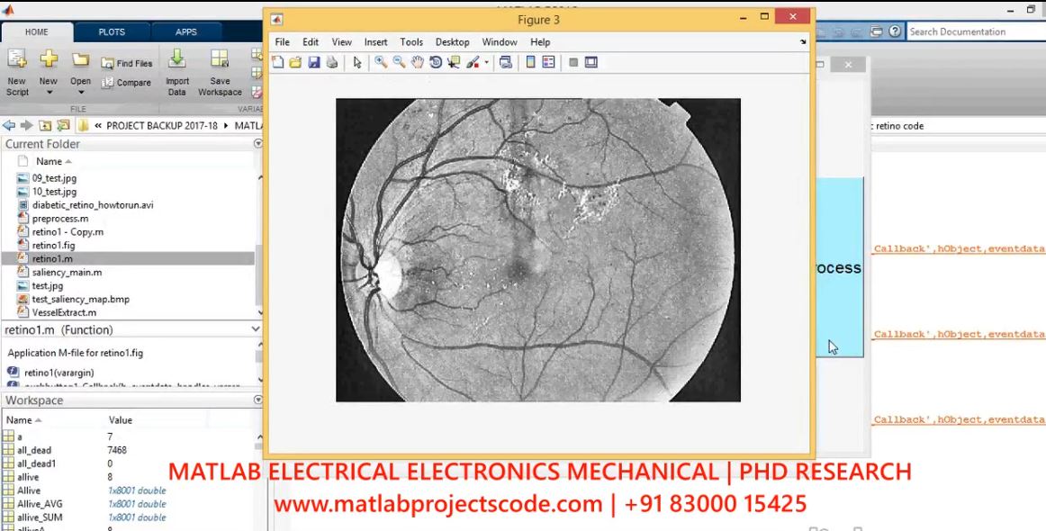 An Efficient Segmentation Of Macular Edema Using Clustering Algorithm project simulation thumbnail for Signal Processing and AI Engineering