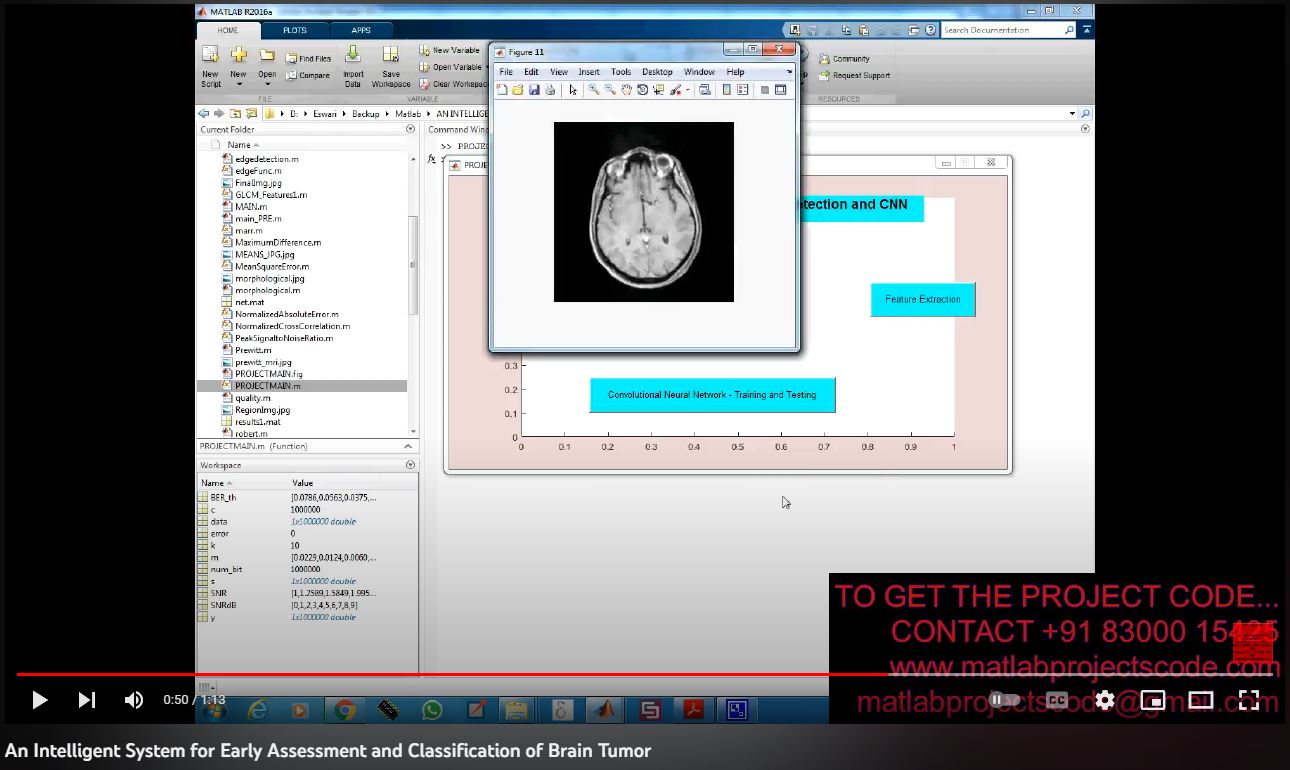 An Intelligent System for Early Assessment and Classification of Brain Tumor project simulation thumbnail for Signal Processing and AI Engineering