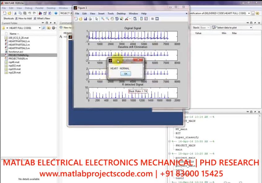 Analysis Of Sound Frequency Ranges For Diagnosing Coronary Artery Disease-Heart Disease project simulation thumbnail for Electrical Engineering
