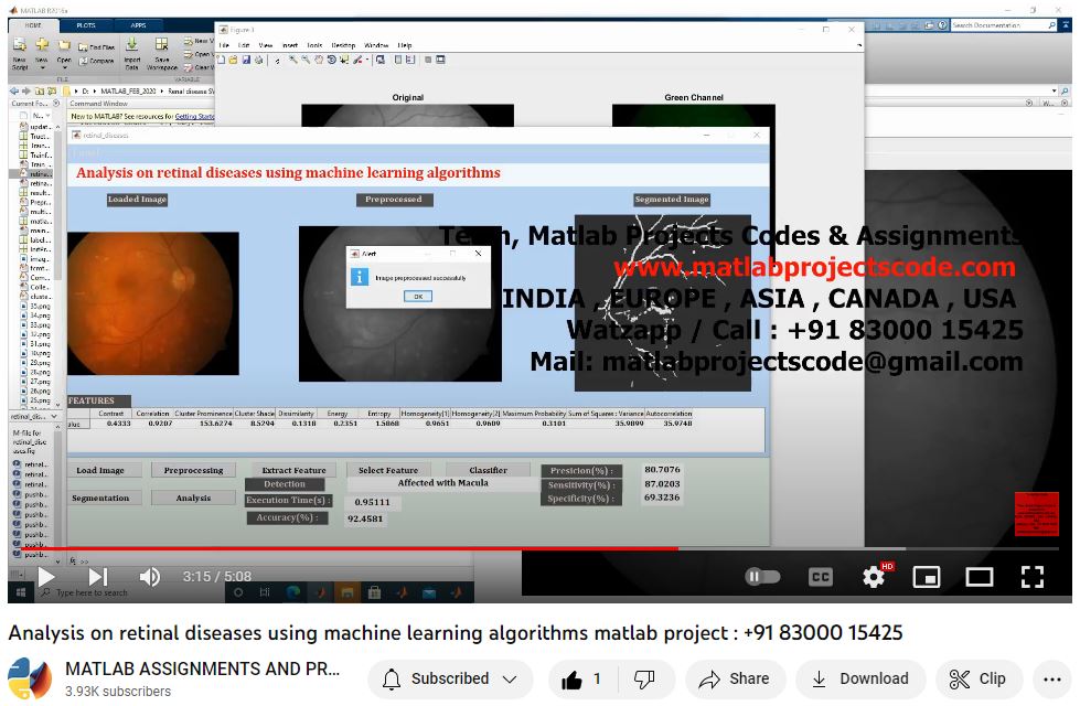 Analysis On Retinal Diseases Using Machine Learning Algorithms Matlab Project project simulation thumbnail for Electrical Engineering