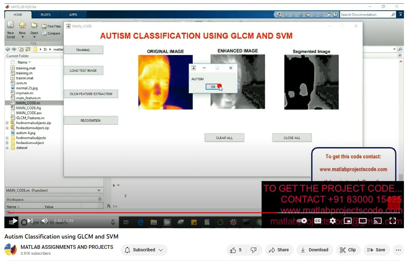 Autism Classification Using Glcm And Svm project simulation thumbnail for Signal Processing and AI Engineering