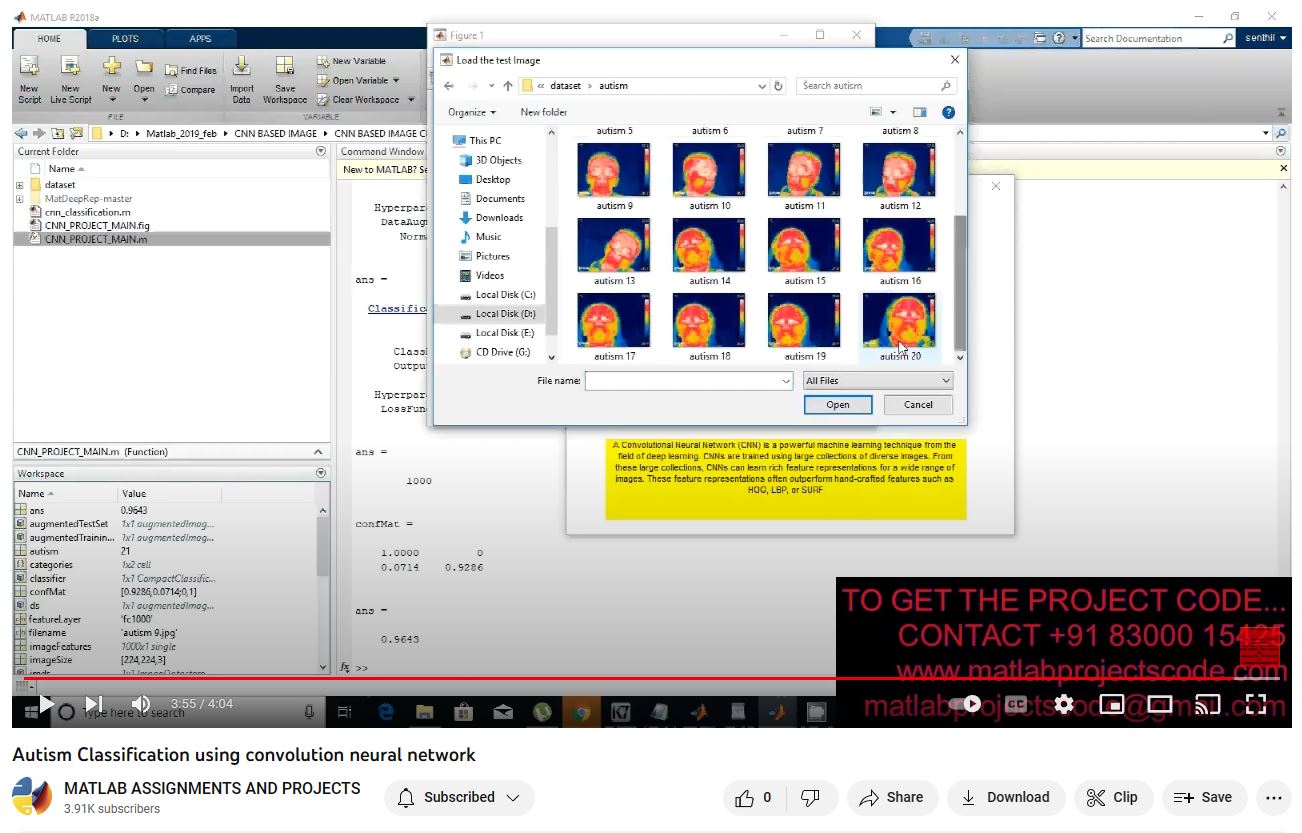 Autism Classification Using Convolution | MATLAB Project