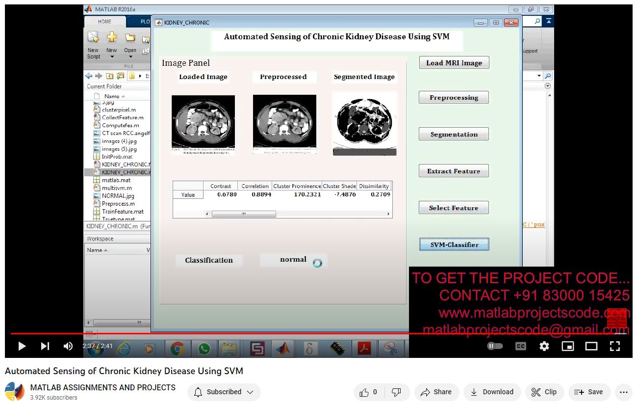 Automated Sensing Of Chronic Kidney Disease Using Svm project simulation thumbnail for Signal Processing and AI Engineering