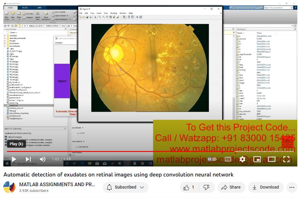 Automatic Detection Of Exudates On Retinal Images Using Deep Convolution Neural Network project simulation thumbnail for Signal Processing and AI Engineering