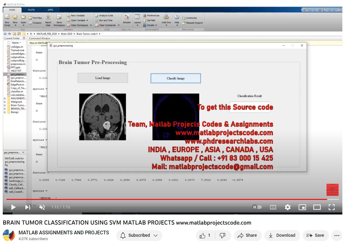 Brain Tumor Classification Using Svm Matlab Projects-Matlab Simulink-Electrical Assignments-Projects-Phd Research project simulation thumbnail for Signal Processing and AI Engineering