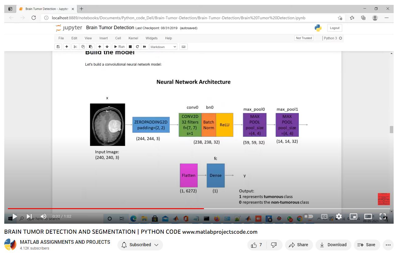 Brain Tumor Detection And Segmentation _ Python Code project simulation thumbnail for Signal Processing and AI Engineering