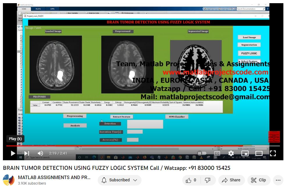 Brain Tumor Detection Using Fuzzy Logic System project simulation thumbnail for Control Systems Engineering