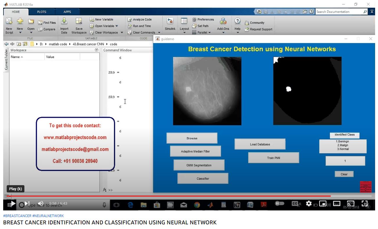 BREAST CANCER IDENTIFICATION AND CLASSIFICATION using NEURAL NETWORK project simulation thumbnail for Communication Systems Engineering