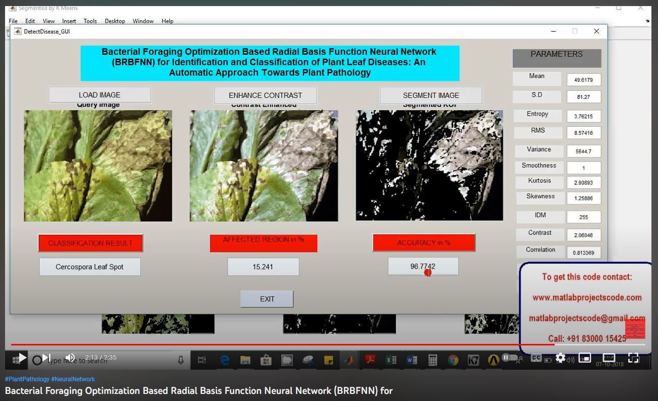 Bacterial Foraging Optimization based Radial Basis Function Neural Network (BRBFNN) for project thumbnail image