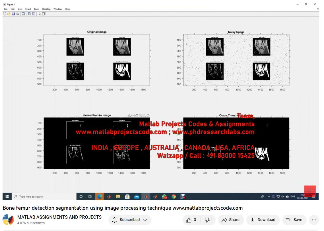 Bone Femur Detection Segmentation Using Image Processing Technique-Matlab Simulink-Electrical Assignments-Projects-Phd Research project simulation thumbnail for Signal Processing and AI Engineering