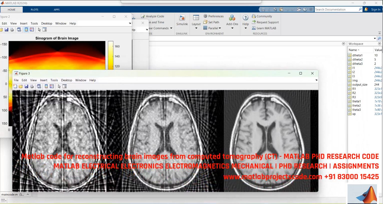Brain Image Reconstruction From Ct Scans - Matlab Code For Phd Medical Imaging Research project simulation thumbnail for Signal Processing and AI Engineering