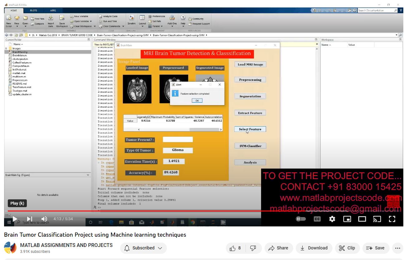 Brain Tumor Classification Project Using Machine Learning Techniques project simulation thumbnail for Signal Processing and AI Engineering