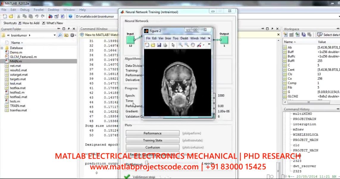 Brain Tumour Classification In Magnetic Resonance Mr Images Using Glcm And Probabilistic Neural Network project thumbnail image