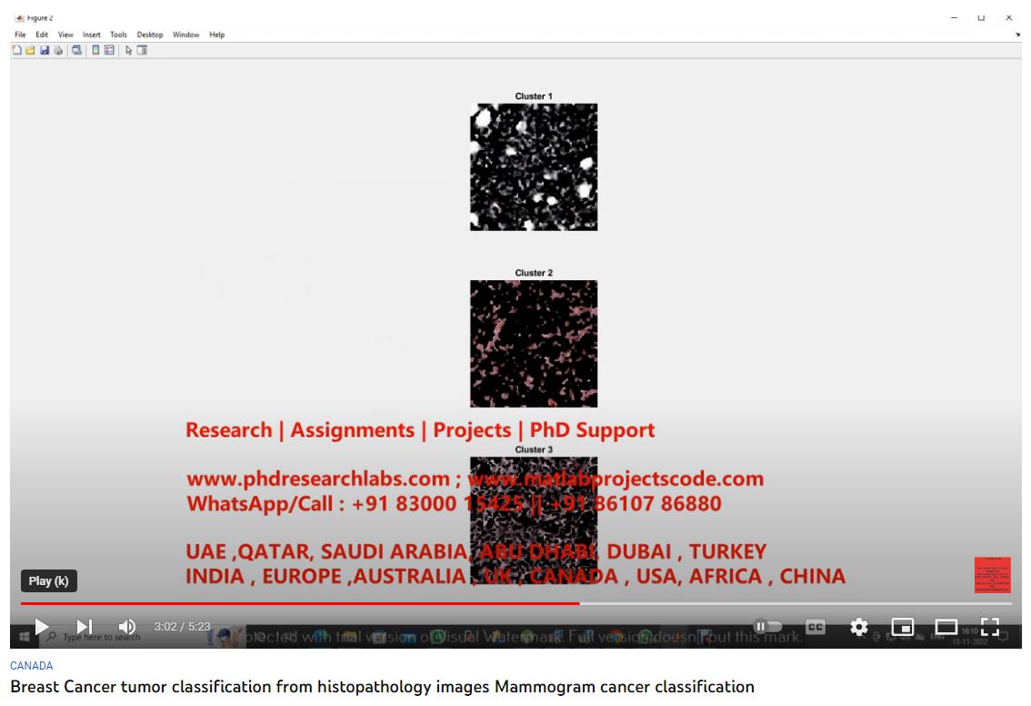 Breast Cancer Tumor Classification from Histopathology Images - Mammogram Cancer Classification project simulation thumbnail for Signal Processing and AI Engineering