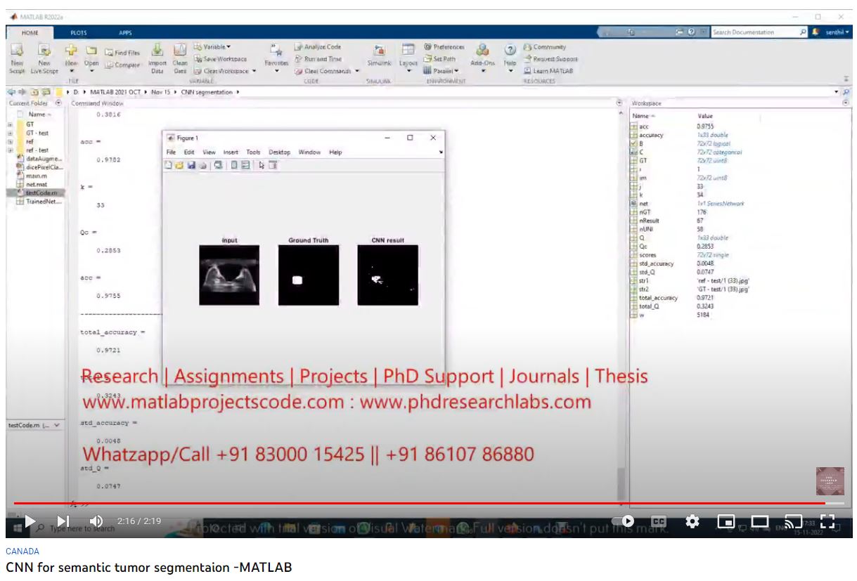 CNN for Semantic Tumor Segmentaion using MATLAB project simulation thumbnail for Signal Processing and AI Engineering