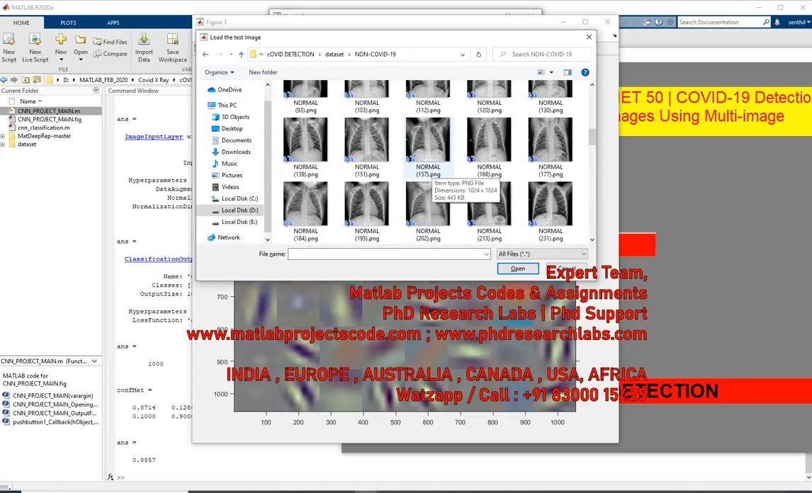 Covid-19 Detection _ Deep Learning project simulation thumbnail for Signal Processing and AI Engineering