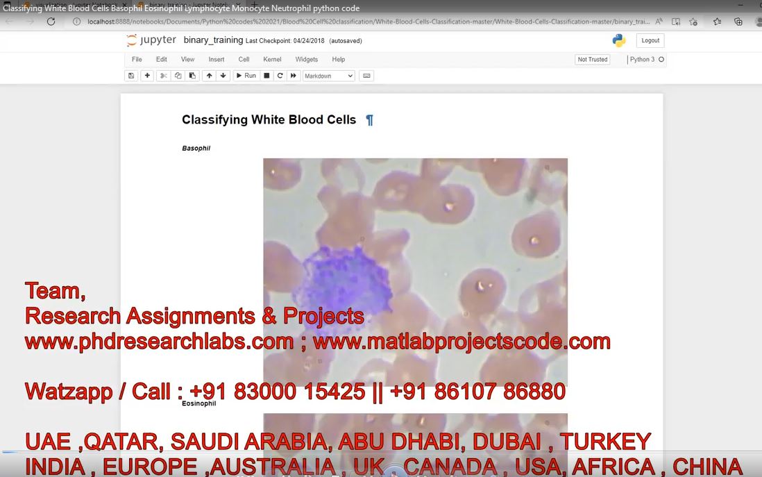 Classifying White Blood Cells Basophil Eosinophil Lymphocyte Monocyte Neutrophil Python Code project simulation thumbnail for Electrical Engineering