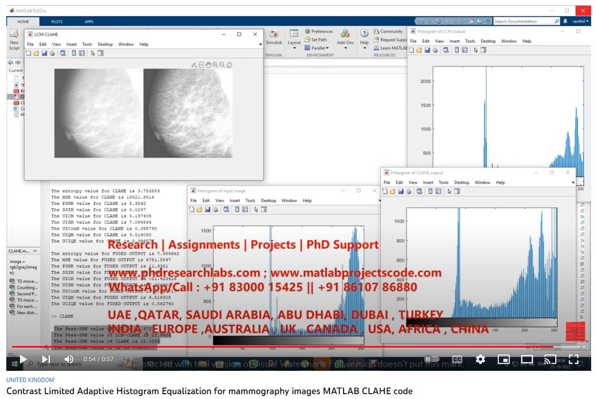 Contrast Limited Adaptive Histogram Equalization for Mammography Images Matllab CLAHE Code project simulation thumbnail for Signal Processing and AI Engineering