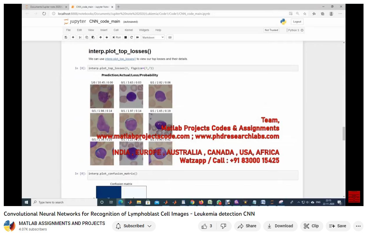 Convolutional Neural Networks For Recognition Of Lymphoblast Cell Images - Leukemia Detection Cnn-Matlab-Electrical Assignments-Projects-Phd Research project simulation thumbnail for Signal Processing and AI Engineering