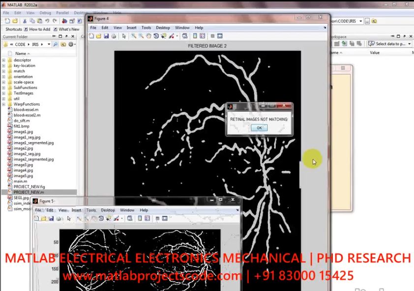 Deep Representations For Iris Spoofing Detection project simulation thumbnail for Signal Processing and AI Engineering
