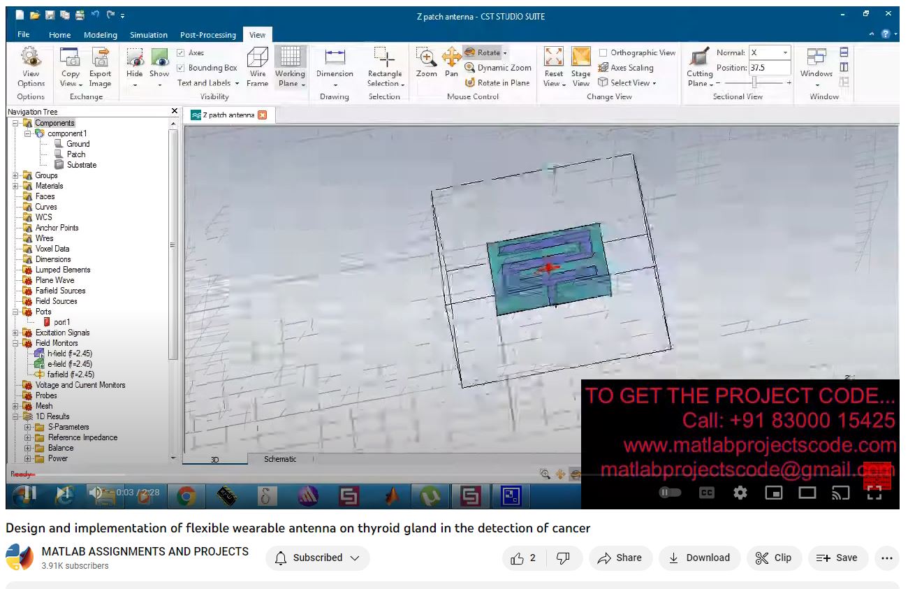 Design And Implementation Of Flexible Wearable Antenna On Thyroid Gland In The Detection Of Cancer project simulation thumbnail for Electromagnetics and RF Engineering