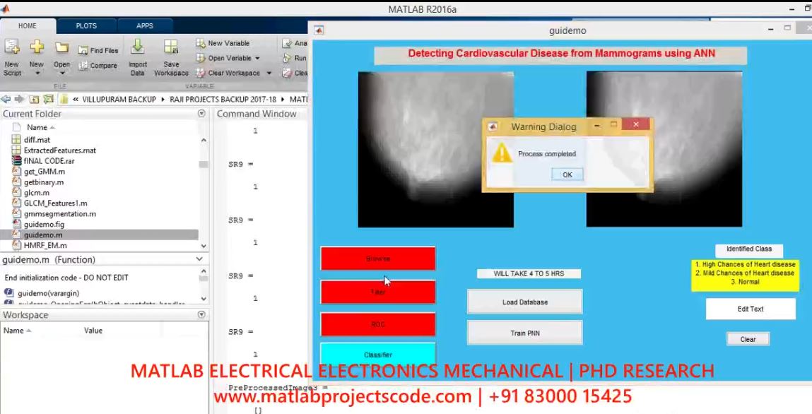 Detecting Cardiovascular Disease From Mammograms With Deep Learning project simulation thumbnail for Electrical Engineering