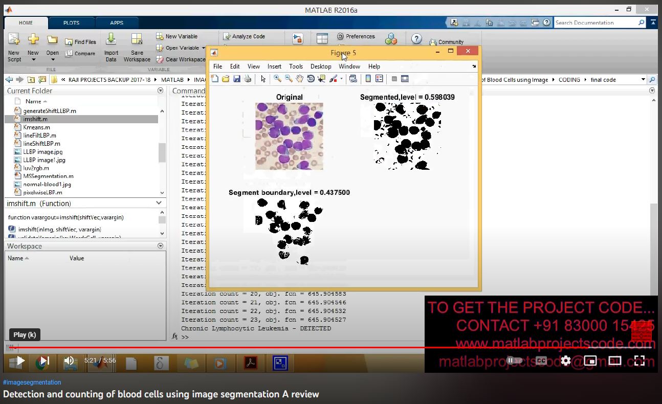 Detection and Counting of Blood Cells using Image Segmentation A Review project simulation thumbnail for Signal Processing and AI Engineering