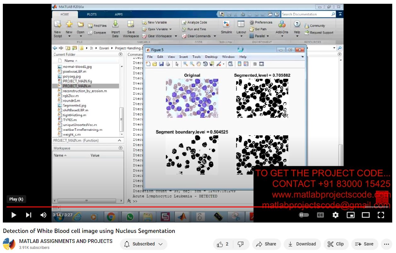 Detection Of White Blood Cell Image Using Nucleus Segmentation project simulation thumbnail for Signal Processing and AI Engineering