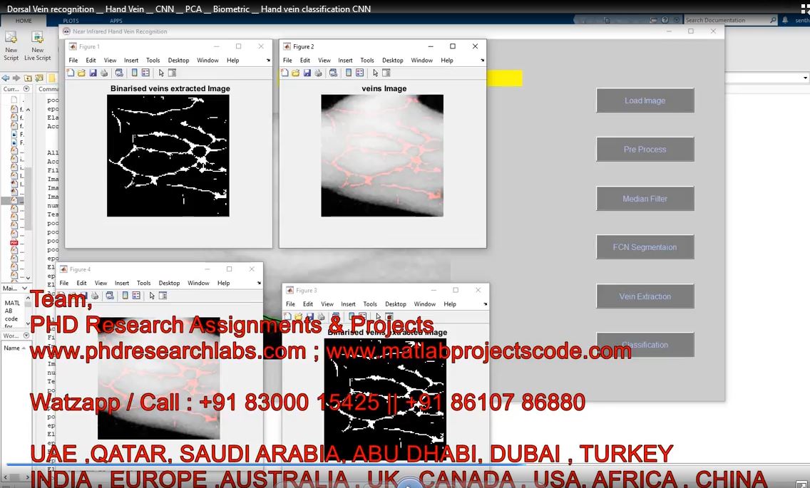 Dorsal Vein Recognition __ Hand Vein __ Cnn __ Pca __ Biometric __ Hand Vein Classification Cnn project simulation thumbnail for Signal Processing and AI Engineering