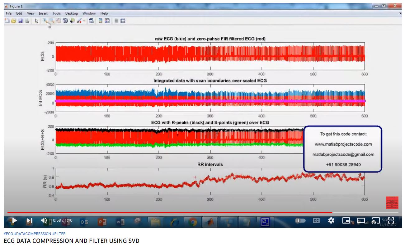 ECG DATA COMPRESSION AND FILTER using SVD project simulation thumbnail for Communication Systems Engineering