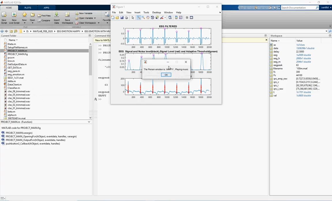 Eeg Emotion Classification With Music _ Brain Wave project simulation thumbnail for Signal Processing and AI Engineering