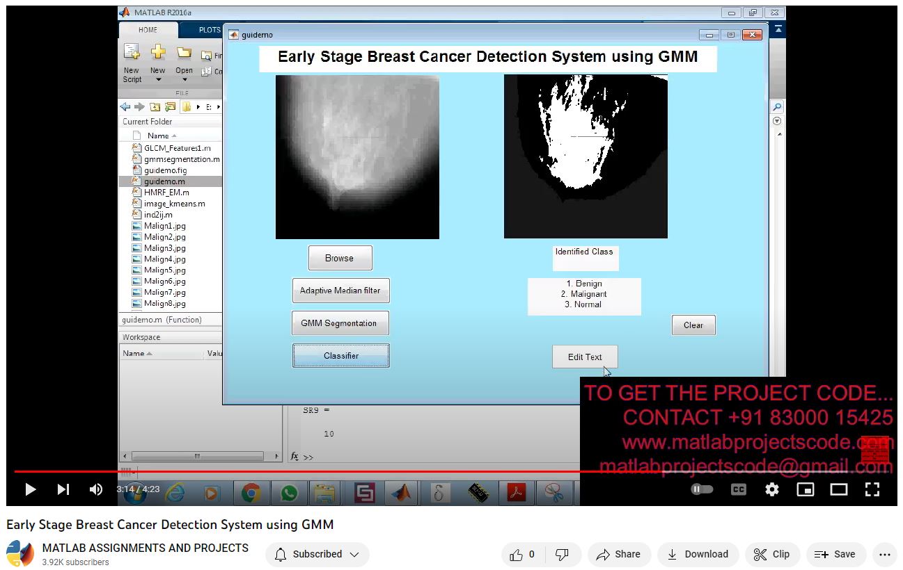 Early Stage Breast Cancer Detection System Using Gmm project simulation thumbnail for Signal Processing and AI Engineering