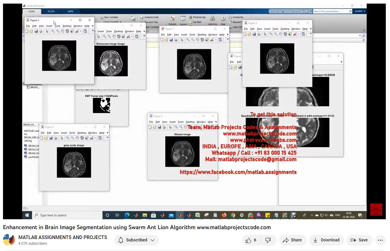 Enhancement In Brain Image Segmentation Using Swarm Ant Lion Algorithm-Matlab Simulink-Electrical Assignments-Projects-Phd Research project simulation thumbnail for Signal Processing and AI Engineering
