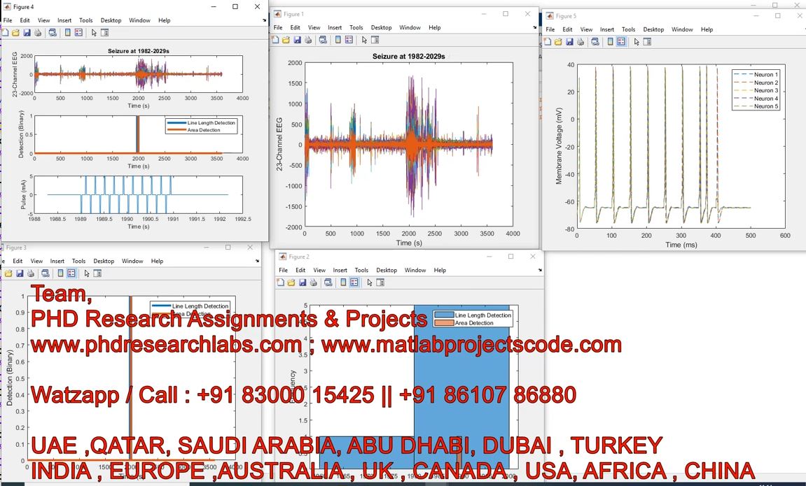 Epilepsy Seizure Detection Using Eeg And Ecg __ Matlab __ Epilepsy Seizure __ Eeg __ Seizure project simulation thumbnail for Signal Processing and AI Engineering
