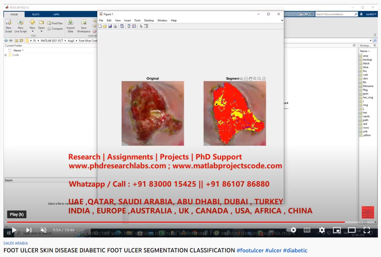 FOOT ULCER SKIN DISEASE - DIABETIC FOOT ULCER SEGMENTATION CLASSIFICATION-MATLAB Assignments project simulation thumbnail for Signal Processing and AI Engineering