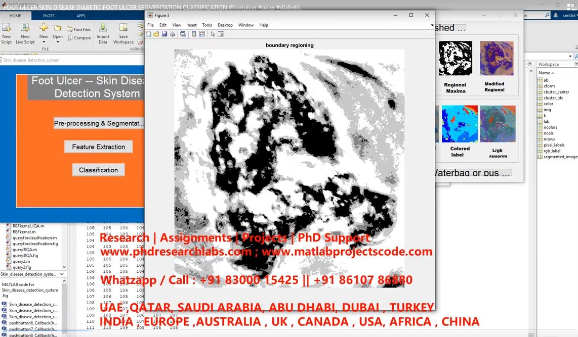 Foot Ulcer Skin Disease Diabetic Foot Ulcer Segmentation Classification project simulation thumbnail for Signal Processing and AI Engineering