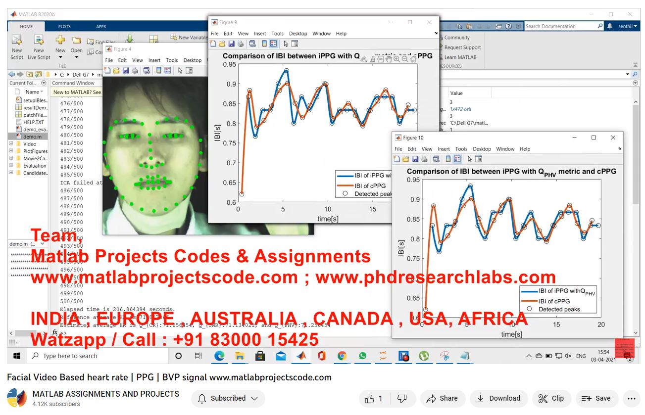 Facial Video Based Heart Rate _ Ppg _ Bvp Signal project simulation thumbnail for Signal Processing and AI Engineering