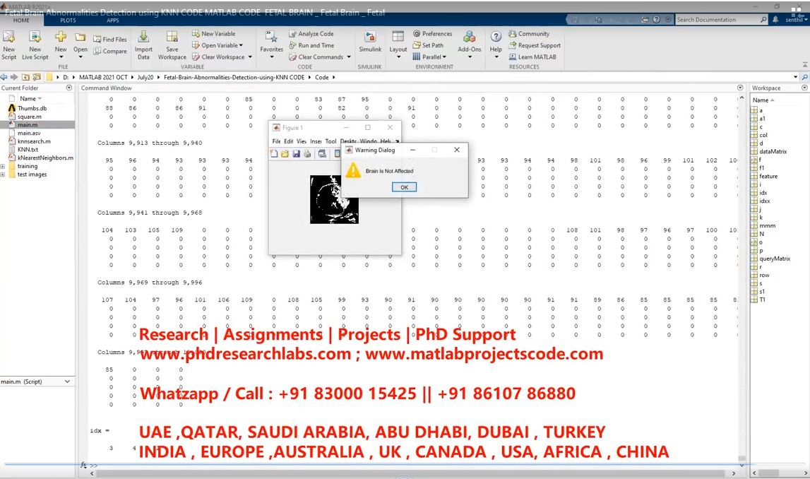 Fetal Brain Abnormalities Detection Using Knn Code Matlab Code Fetal Brain _ Fetal Brain _ Fetal project simulation thumbnail for Signal Processing and AI Engineering