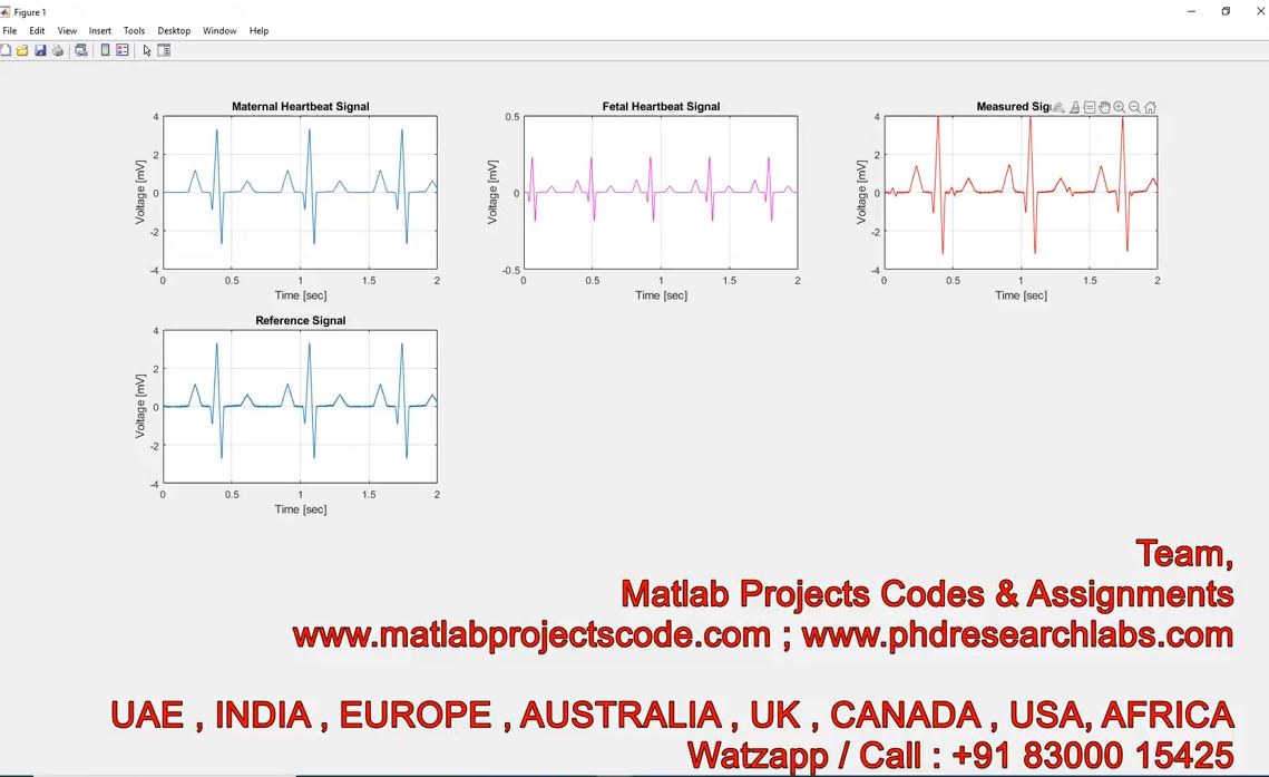 Fetal Ecg Extraction Simulink Model - Fecg - Fetal Ecg - Matlab - Ecg - Simulink project simulation thumbnail for Mechanical, EV and Mechatronics Engineering
