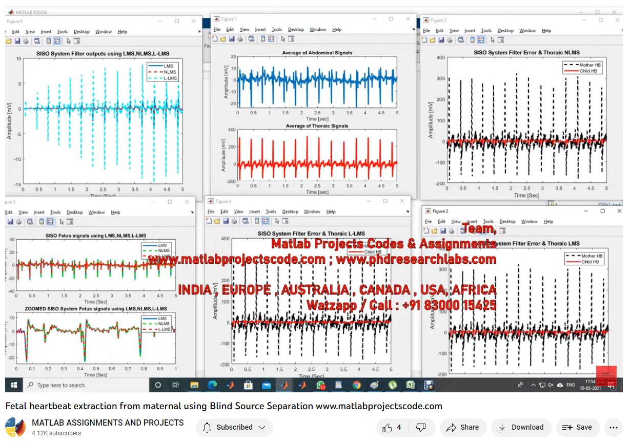 Fetal Heartbeat Extraction From Maternal Using Blind Source Separation project simulation thumbnail for Mechanical, EV and Mechatronics Engineering
