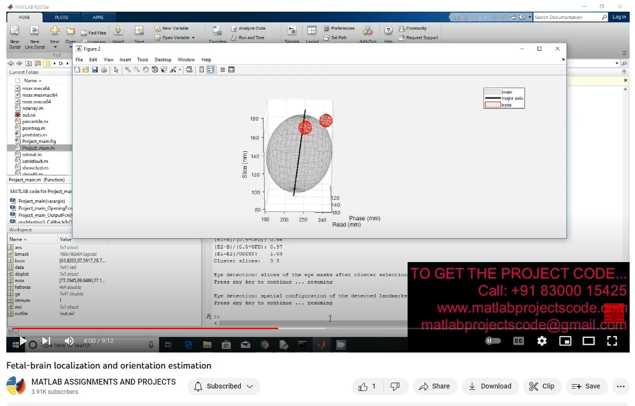 Fetal-Brain Localization And Orientation Estimation project simulation thumbnail for Signal Processing and AI Engineering
