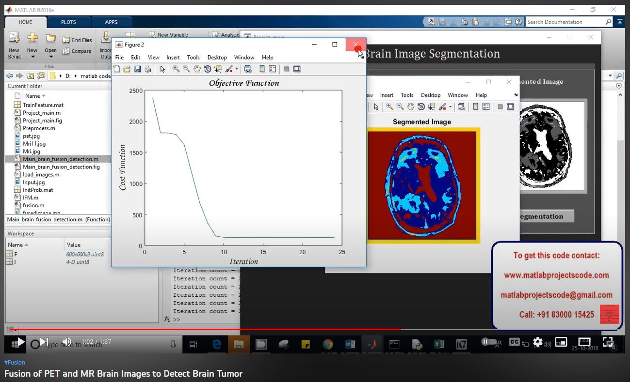 Fusion of PET and MR Brain Images to Detect Brain Tumor project simulation thumbnail for Signal Processing and AI Engineering