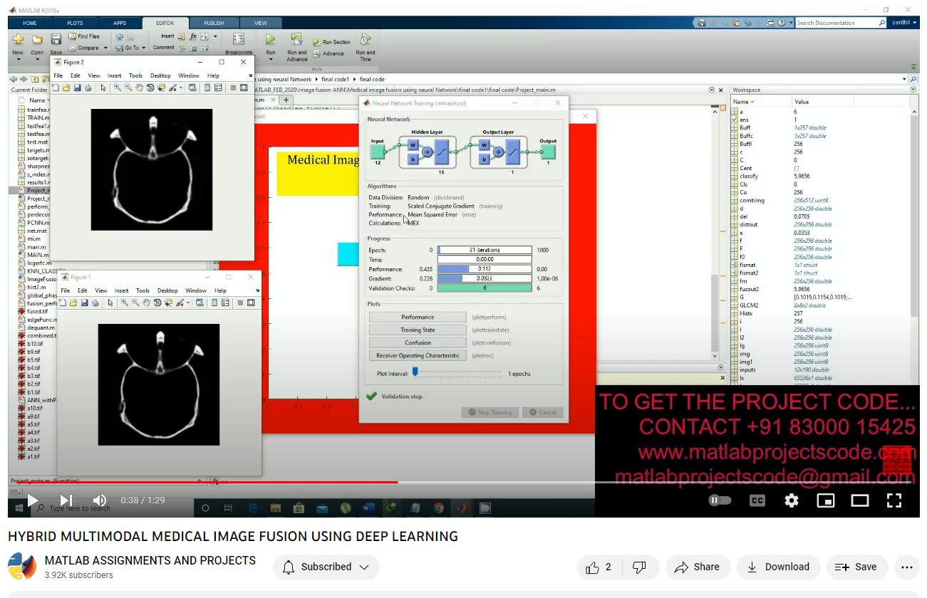 Hybrid Multimodal Medical Image Fusion Using Deep Learning project simulation thumbnail for Signal Processing and AI Engineering